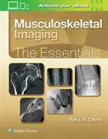 L'imagerie musculo-squelettique : L'essentiel - Musculoskeletal Imaging: The Essentials