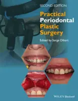 Chirurgie plastique parodontale pratique - Practical Periodontal Plastic Surgery