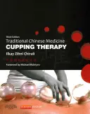 Médecine traditionnelle chinoise : thérapie par les ventouses - Traditional Chinese Medicine Cupping Therapy