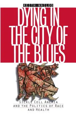 Mourir dans la ville du blues : L'anémie à cellules souches et la politique de la race et de la santé - Dying in the City of the Blues: Sickel Cell Anemia and the Politics of Race and Health
