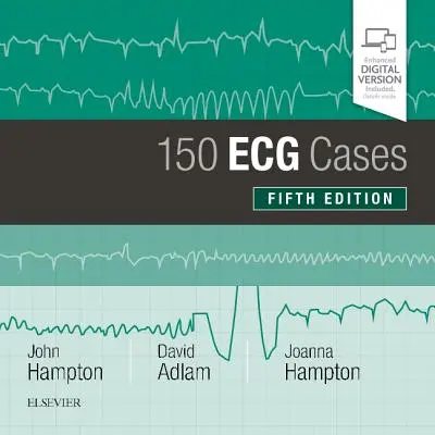 150 cas d'ECG - 150 ECG Cases