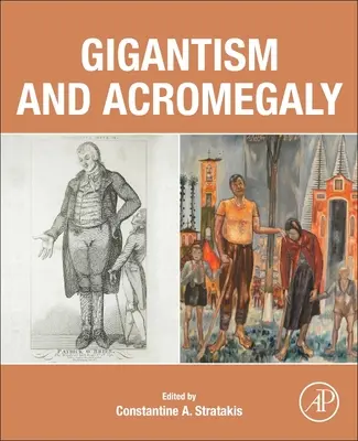 Gigantisme et acromégalie - Gigantism and Acromegaly