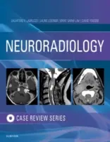 Examen de cas d'imagerie en neuroradiologie - Neuroradiology Imaging Case Review