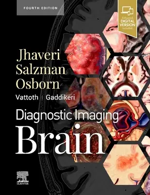 Imagerie diagnostique : Cerveau - Diagnostic Imaging: Brain