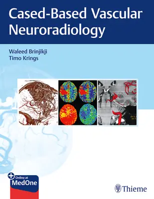 L'imagerie dans les maladies neurovasculaires : Une approche basée sur les cas - Imaging in Neurovascular Disease: A Case-Based Approach