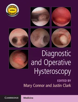 L'hystéroscopie diagnostique et opératoire - Diagnostic and Operative Hysteroscopy