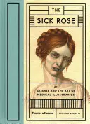 Sick Rose - Or ; Disease and the Art of Medical Illustration (La maladie et l'art de l'illustration médicale) - Sick Rose - Or; Disease and the Art of Medical Illustration