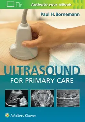 Échographie pour les soins primaires [Avec eBook] - Ultrasound for Primary Care [With eBook]