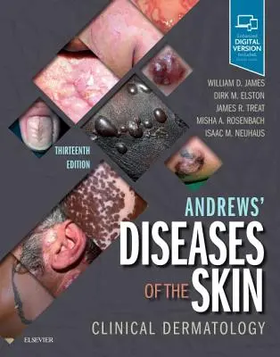 Les maladies de la peau d'Andrews : Dermatologie clinique - Andrews' Diseases of the Skin: Clinical Dermatology
