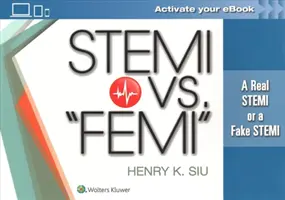 Stemi vs. Femi » : Un vrai Stemi ou un faux Stemi ? - Stemi vs. Femi