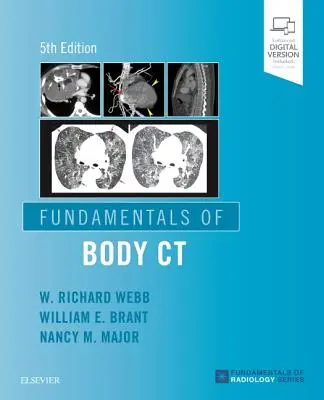 Principes fondamentaux de la tomodensitométrie corporelle - Fundamentals of Body CT