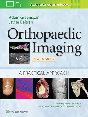 Imagerie orthopédique : Une approche pratique - Orthopaedic Imaging: A Practical Approach