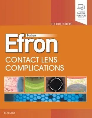 Complications des lentilles de contact - Contact Lens Complications