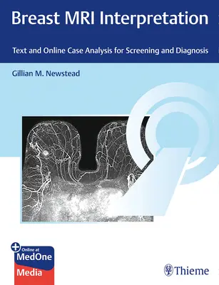 Interprétation de l'IRM mammaire : Texte et analyse de cas en ligne pour le dépistage et le diagnostic - Breast MRI Interpretation: Text and Online Case Analysis for Screening and Diagnosis