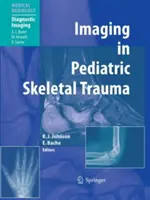 L'imagerie en traumatologie squelettique pédiatrique : Techniques et applications - Imaging in Pediatric Skeletal Trauma: Techniques and Applications