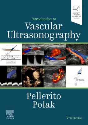 Introduction à l'échographie vasculaire - Introduction to Vascular Ultrasonography