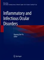 Troubles oculaires inflammatoires et infectieux - Inflammatory and Infectious Ocular Disorders