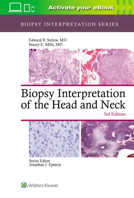 Interprétation des biopsies de la tête et du cou - Biopsy Interpretation of the Head and Neck