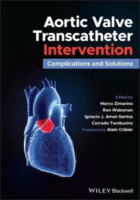 Intervention transcathéter sur la valve aortique : Complications et solutions - Aortic Valve Transcatheter Intervention: Complications and Solutions