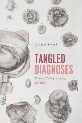 Diagnostics enchevêtrés : Tests prénataux, femmes et risques - Tangled Diagnoses: Prenatal Testing, Women, and Risk