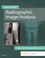 Analyse d'images radiographiques - Radiographic Image Analysis