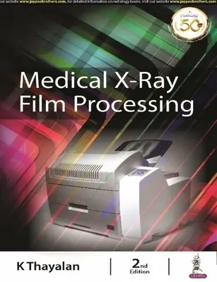 Traitement des films radiographiques médicaux - Medical X-ray Film Processing