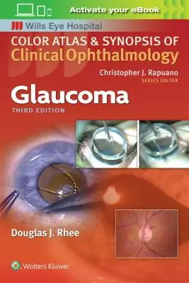 Glaucome - Glaucoma