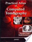 Atlas pratique de la tomographie assistée par ordinateur - Practical Atlas of Computed Tomography