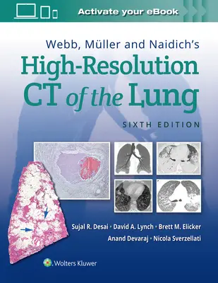 La tomodensitométrie haute résolution du poumon de Webb, Mller et Naidich - Webb, Mller and Naidich's High-Resolution CT of the Lung