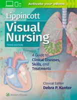 Lippincott Visual Nursing : Un guide des maladies cliniques, des compétences et des traitements - Lippincott Visual Nursing: A Guide to Clinical Diseases, Skills, and Treatments