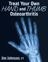 Traitez vous-même l'arthrose de la main et du pouce - Treat Your Own Hand and Thumb Osteoarthritis