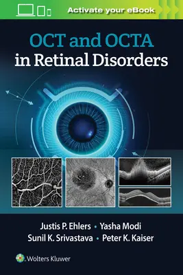 Oct et Octa dans les troubles rétiniens - Oct and Octa in Retinal Disorders