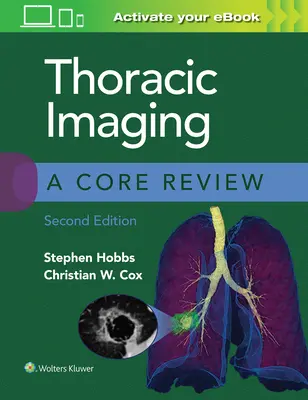 Imagerie thoracique : A Core Review - Thoracic Imaging: A Core Review