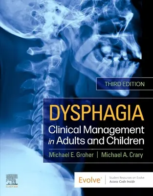 Dysphagie - Prise en charge clinique chez l'adulte et l'enfant - Dysphagia - Clinical Management in Adults and Children