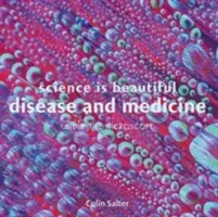 La science est belle : La maladie et la médecine : Sous le microscope - Science Is Beautiful: Disease and Medicine: Under the Microscope