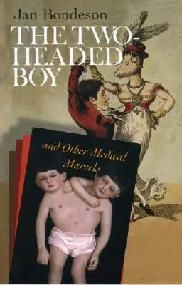 Le garçon à deux têtes et autres merveilles médicales - The Two-Headed Boy, and Other Medical Marvels