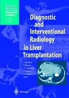 Radiologie diagnostique et interventionnelle dans la transplantation hépatique - Diagnostic and Interventional Radiology in Liver Transplantation