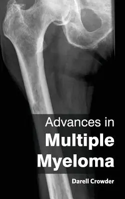 Avancées dans le domaine du myélome multiple - Advances in Multiple Myeloma