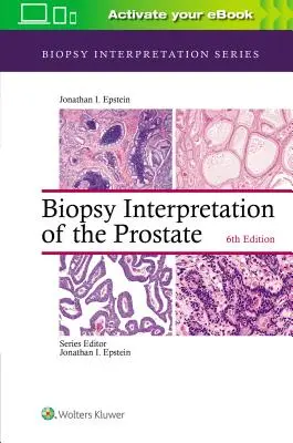 Interprétation de la biopsie de la prostate - Biopsy Interpretation of the Prostate