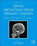 Métastases cérébrales des tumeurs primaires, Volume 2 : Épidémiologie, biologie et thérapie - Brain Metastases from Primary Tumors, Volume 2: Epidemiology, Biology, and Therapy