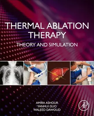 Thérapie d'ablation thermique : Théorie et simulation - Thermal Ablation Therapy: Theory and Simulation