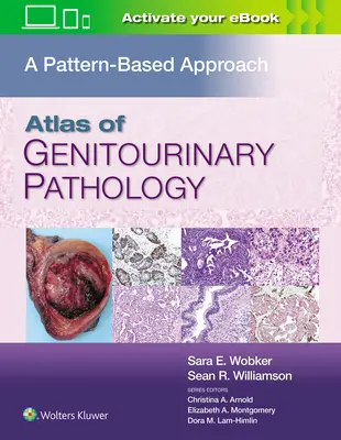 Atlas de pathologie génito-urinaire : Une approche basée sur les modèles - Atlas of Genitourinary Pathology: A Pattern Based Approach