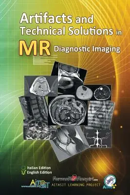 Artéfacts et solutions techniques en imagerie diagnostique par RM - Artifacts and Technical Solutions in MR Diagnostic Imaging