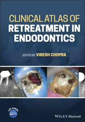 Atlas clinique du retraitement en endodontie - Clinical Atlas of Retreatment in Endodontics