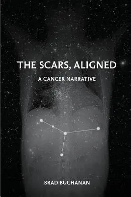 Les cicatrices, alignées - The Scars, Aligned