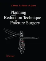 Planification et technique de réduction dans la chirurgie des fractures - Planning and Reduction Technique in Fracture Surgery