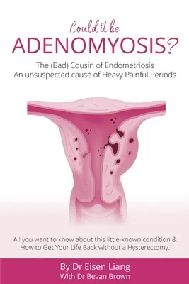 Adénomyose - La mauvaise cousine de l'endométriose : Une cause insoupçonnée de règles douloureuses et abondantes - Adenomyosis -The Bad Cousin of Endometriosis: An unsuspected cause of Heavy Painful Periods