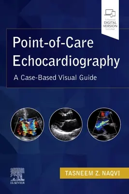 L'échocardiographie au point de service : Un guide visuel basé sur des cas cliniques - Point-Of-Care Echocardiography: A Clinical Case-Based Visual Guide