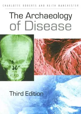 L'archéologie de la maladie - The Archaeology of Disease