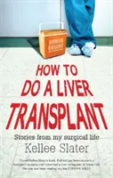 Comment faire une greffe de foie : Histoires de ma vie chirurgicale - How to do a liver transplant: Stories from my surgical life